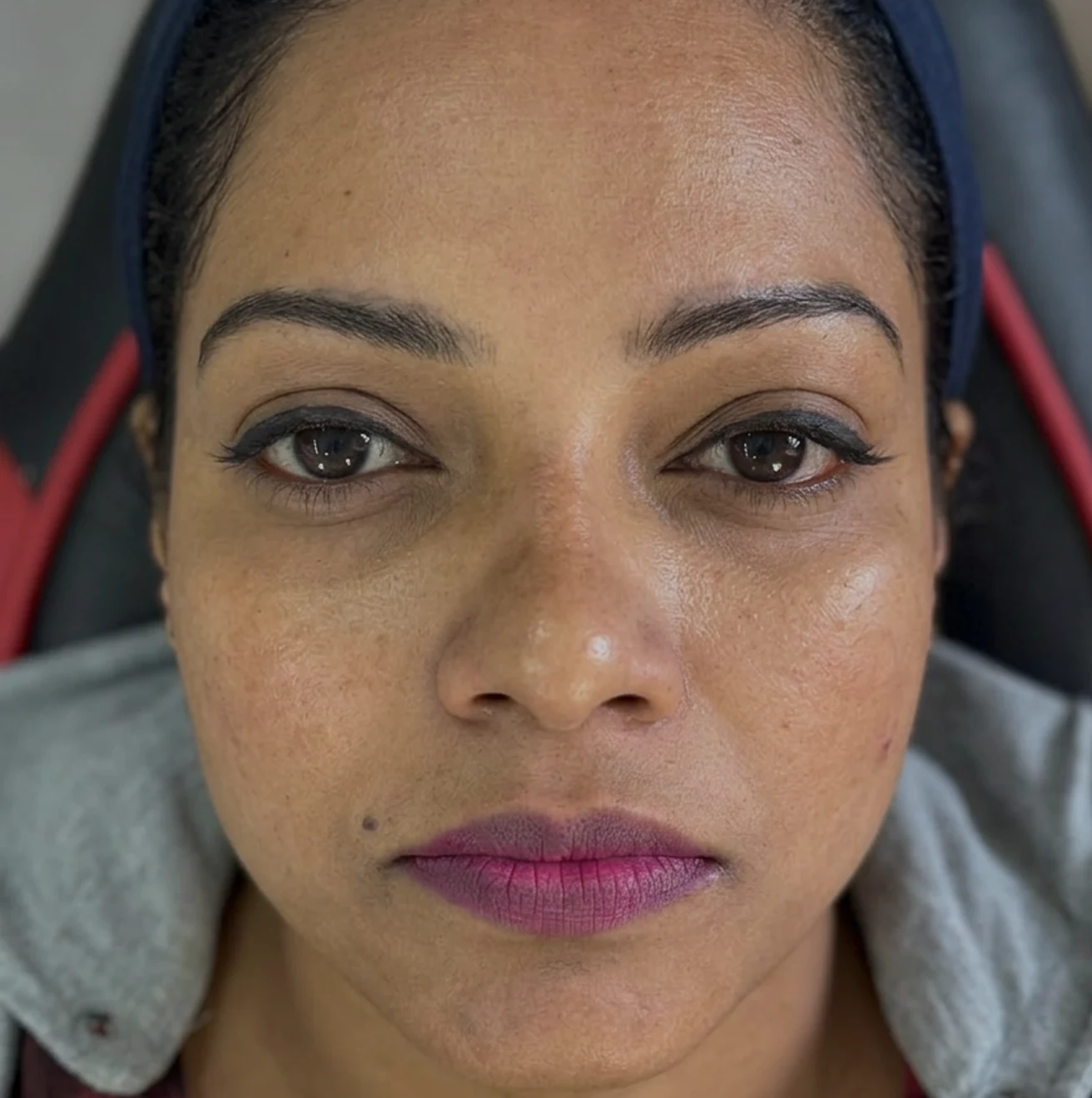 Woman with stained teeth