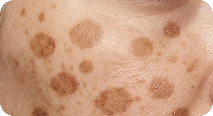 Skin is being Primed