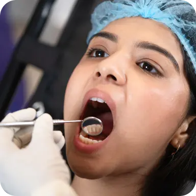 Advanced cavity prevention with sealant and fluoride at home